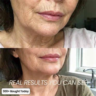 PDRN Pink Collagen Volume Multi Balm